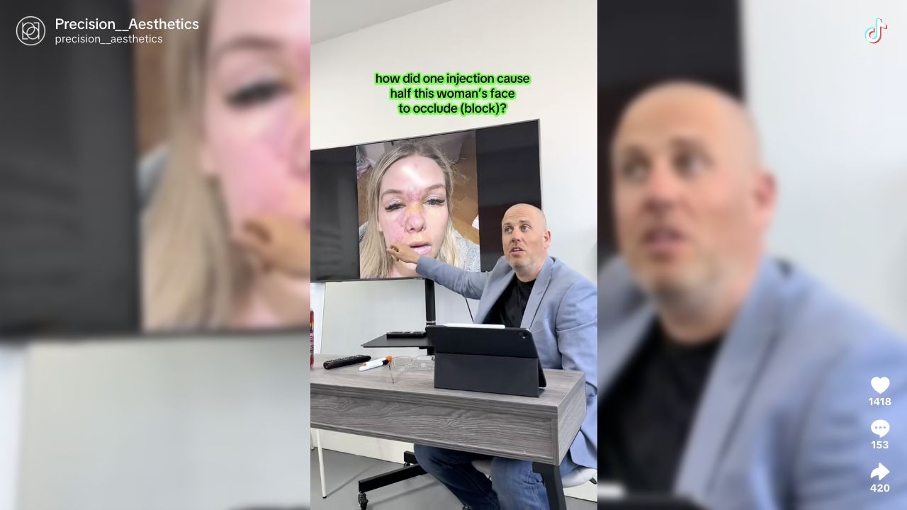 Adam explaining the half-face VO case; includes clinical imagery
